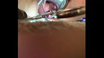 play Innenansicht des Orgasmus mit Sound Tenaculum und Vibrator